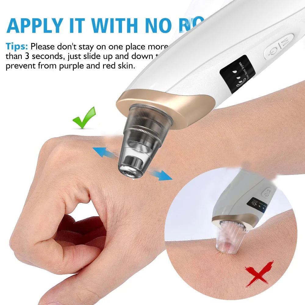 Upgraded Blackhead Remover Vacuum Facial Pore Cleaner Electric Acne Comedone Whitehead Extractor Tool 5 Probes For Women And Men