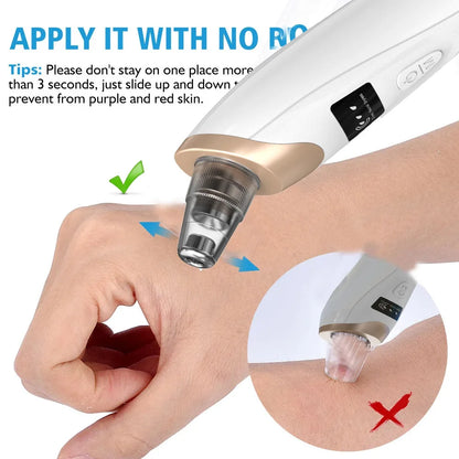 Upgraded Blackhead Remover Vacuum Facial Pore Cleaner Electric Acne Comedone Whitehead Extractor Tool 5 Probes For Women And Men